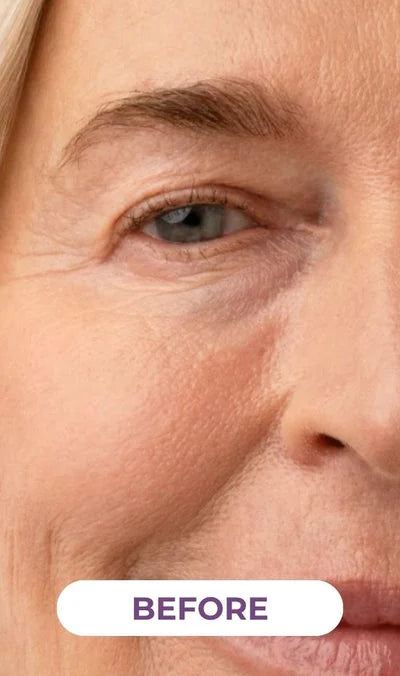 Patricia, 63