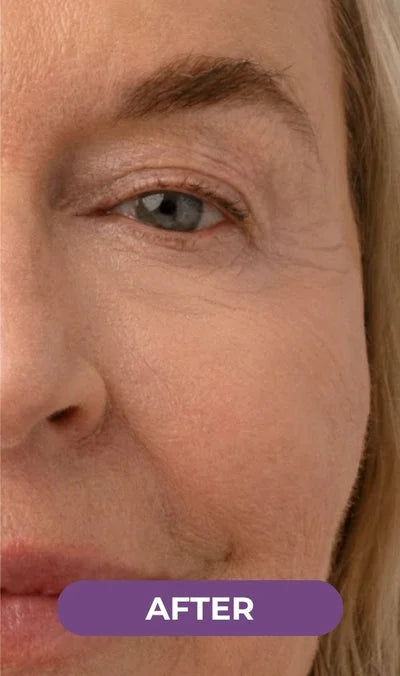 Patricia, 63